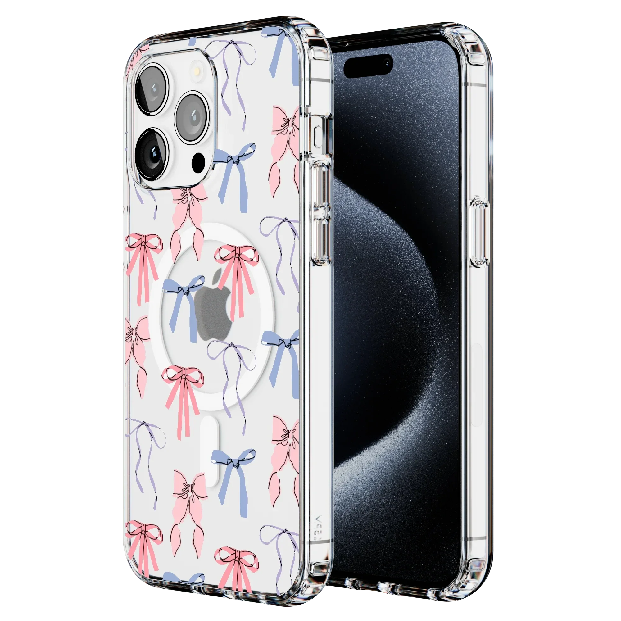 Coquette Girlie | Pastel Bows Case