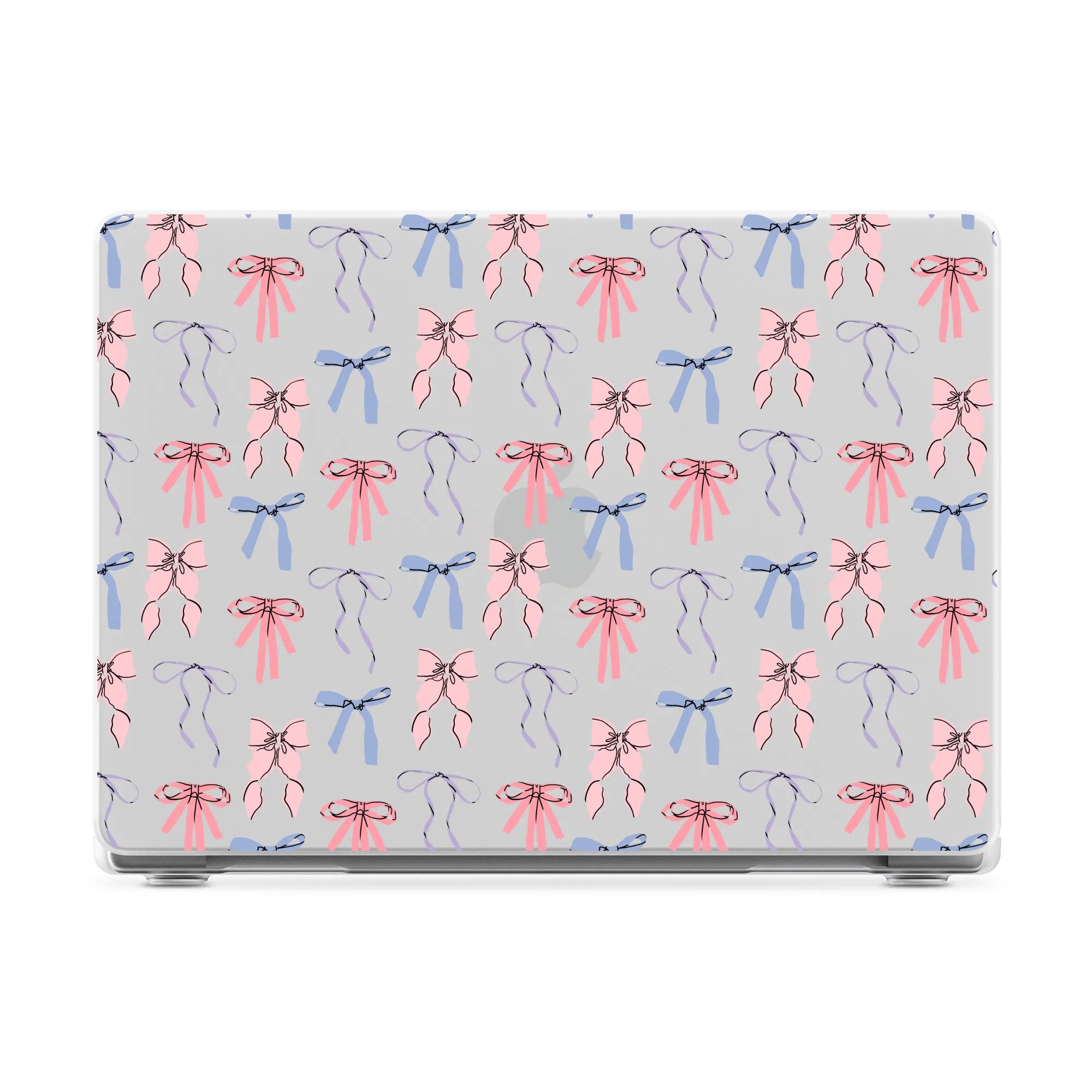 Coquette Girlie | Pastel Bows Laptop Shell