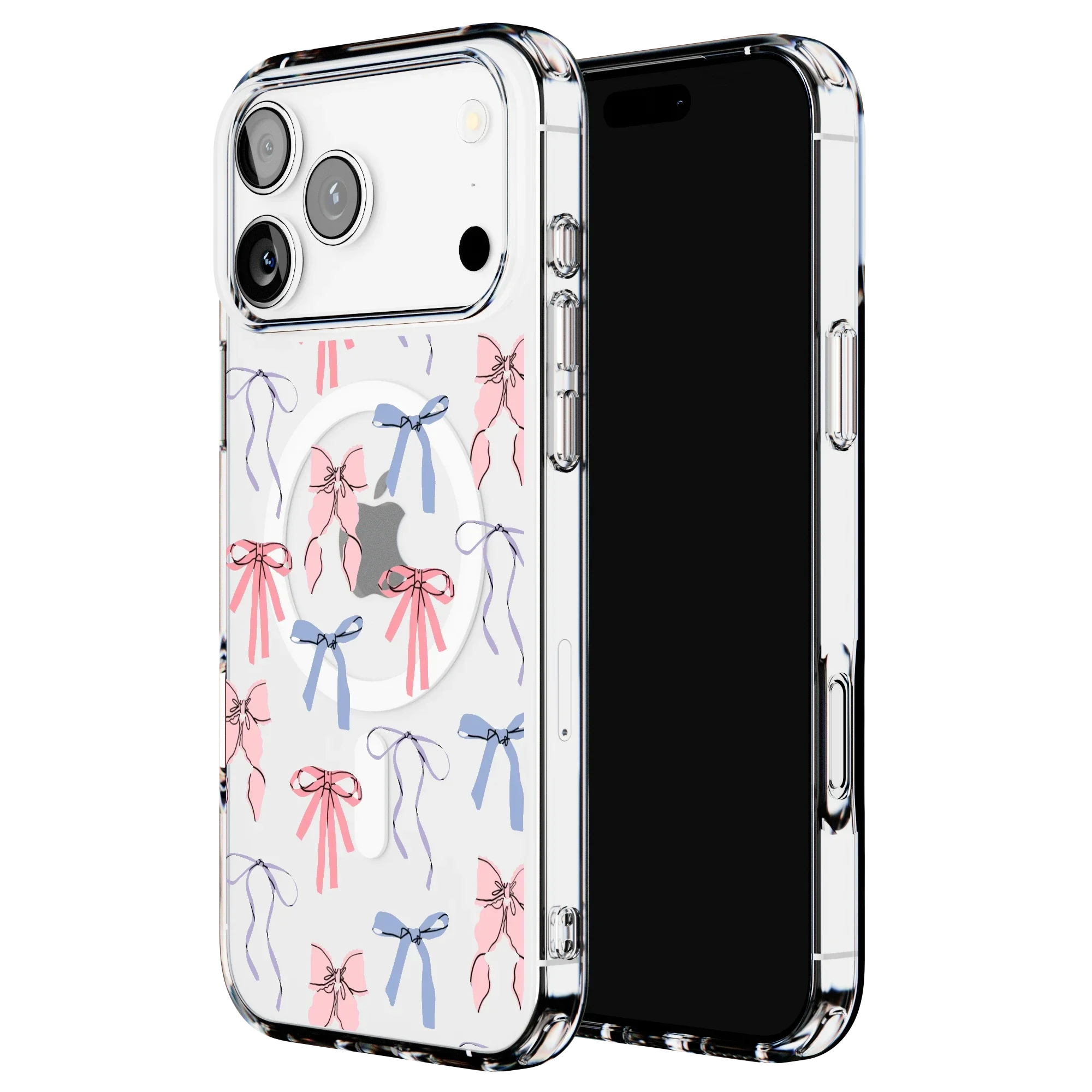 Coquette Girlie | Pastel Bows Case