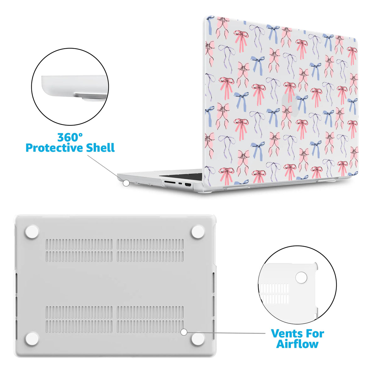 Coquette Girlie | Pastel Bows Laptop Shell