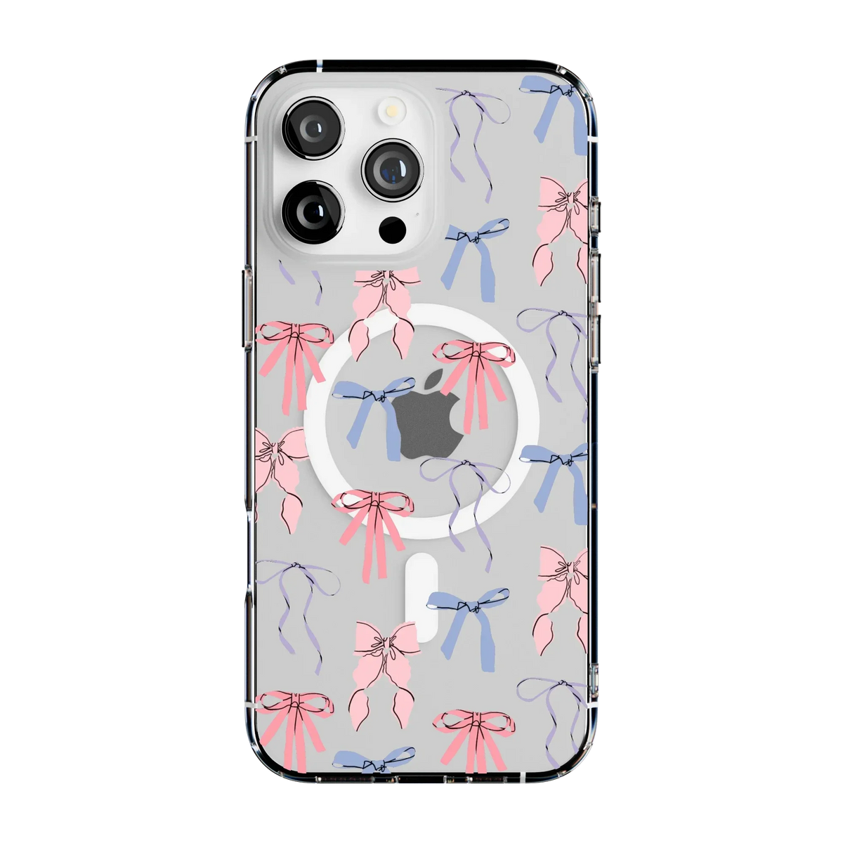 Coquette Girlie | Pastel Bows Case