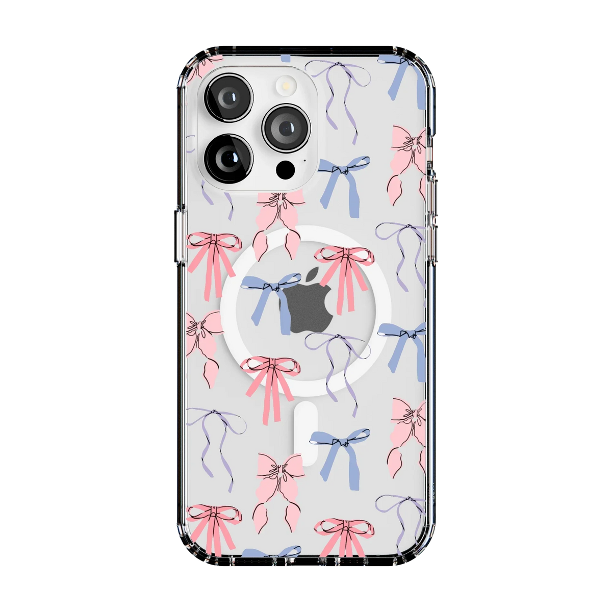 Coquette Girlie | Pastel Bows Case