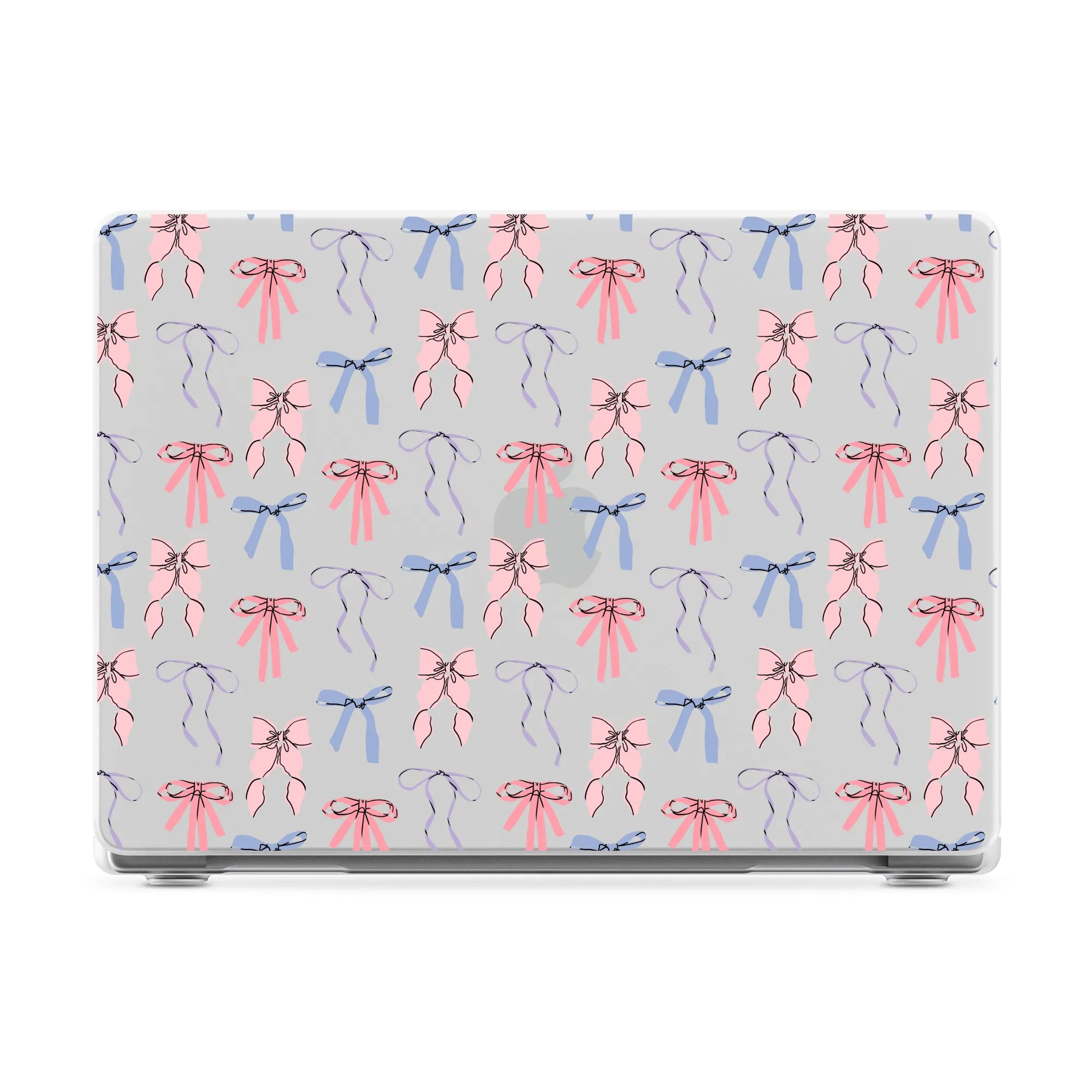 Coquette Girlie | Pastel Bows Laptop Shell