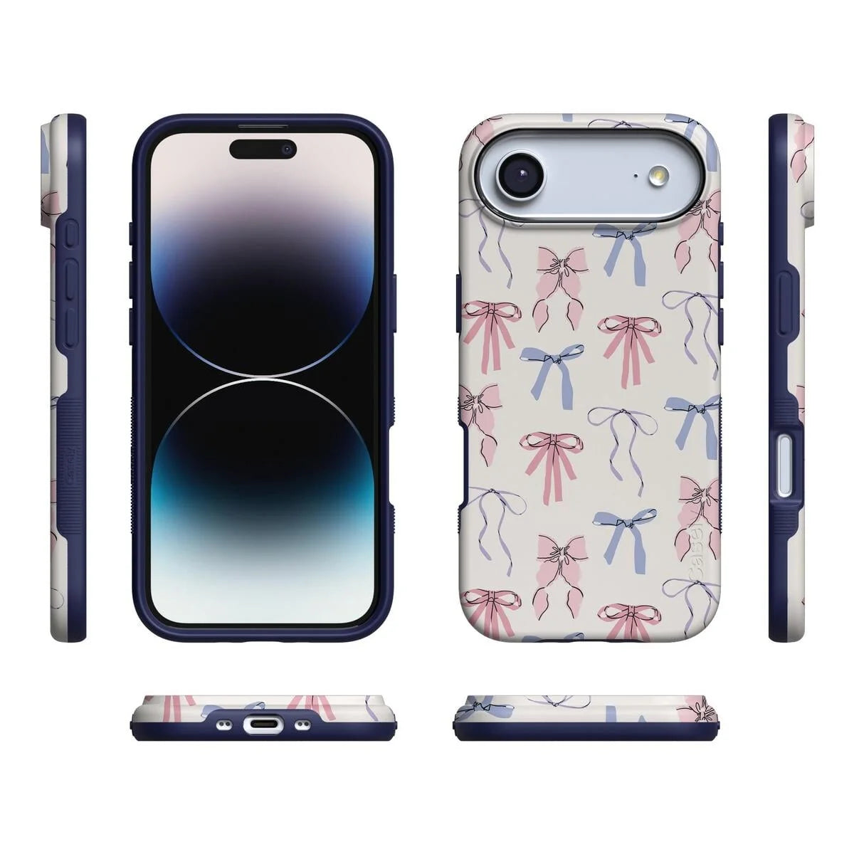 Coquette Girlie | Pastel Bows Case